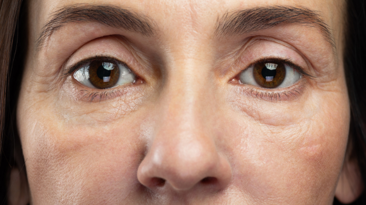 Skin Aging Essentials - Solution for Pigmentation and Elasticity